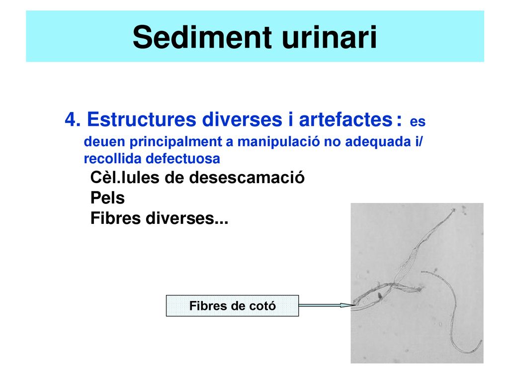 Sediment urinari 4. Estructures diverses i artefactes : es deuen principalment a manipulació no adequada i/ recollida defectuosa.
