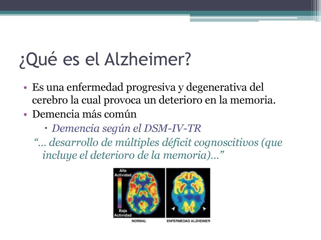 ¿Qué es el Alzheimer Es una enfermedad progresiva y degenerativa del cerebro la cual provoca un deterioro en la memoria.