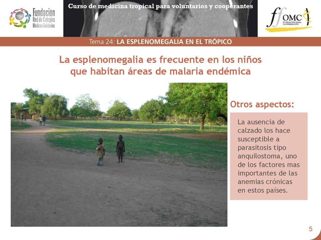 La esplenomegalia es frecuente en los niños que habitan áreas de malaria endémica