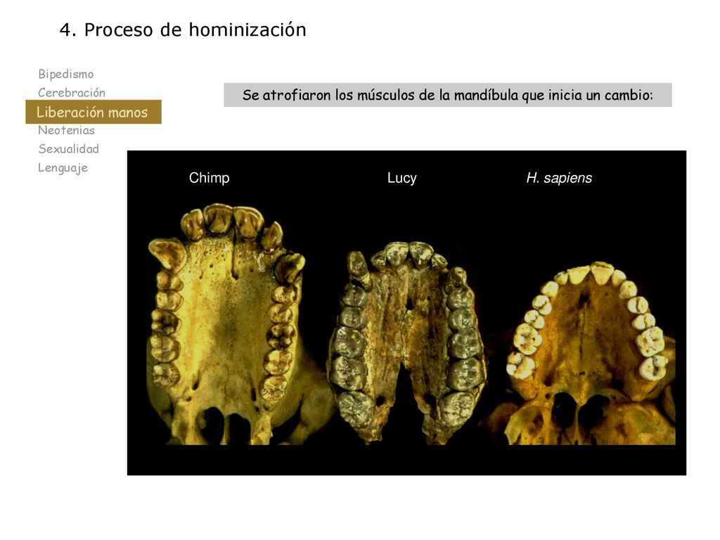 Se atrofiaron los músculos de la mandíbula que inicia un cambio: