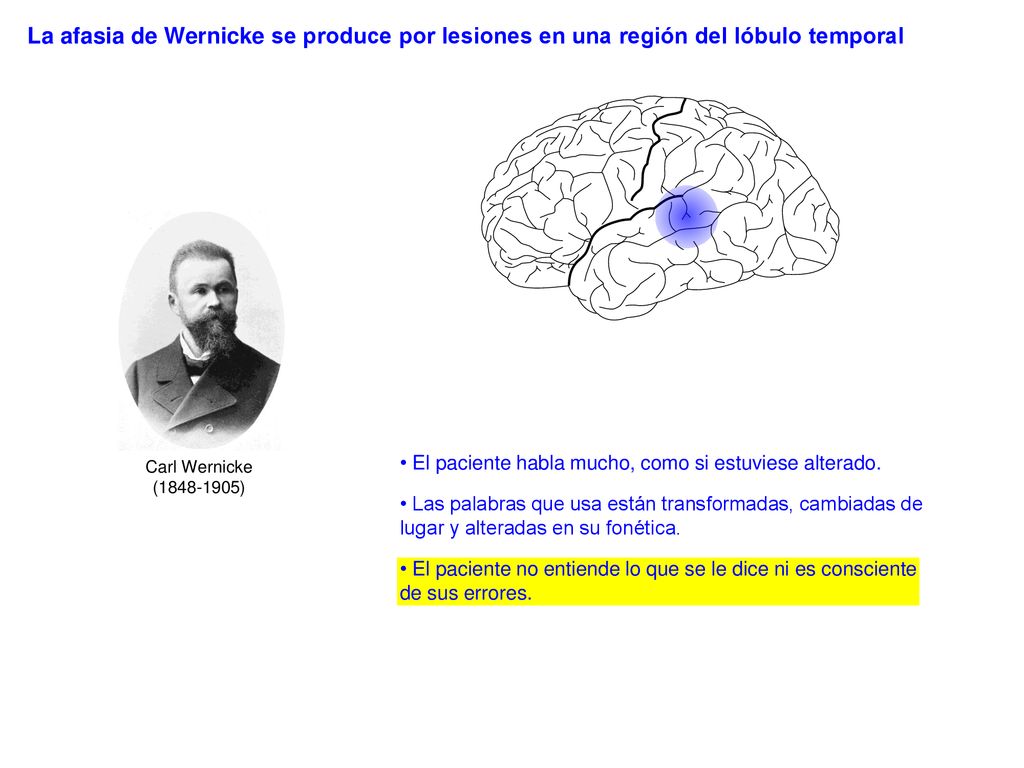 La afasia de Wernicke se produce por lesiones en una región del lóbulo temporal
