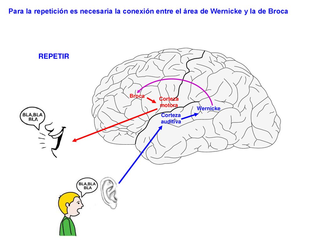 Para la repetición es necesaria la conexión entre el área de Wernicke y la de Broca