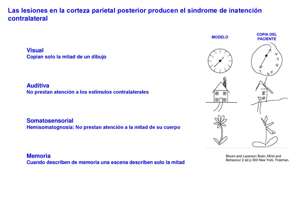 Las lesiones en la corteza parietal posterior producen el síndrome de inatención contralateral