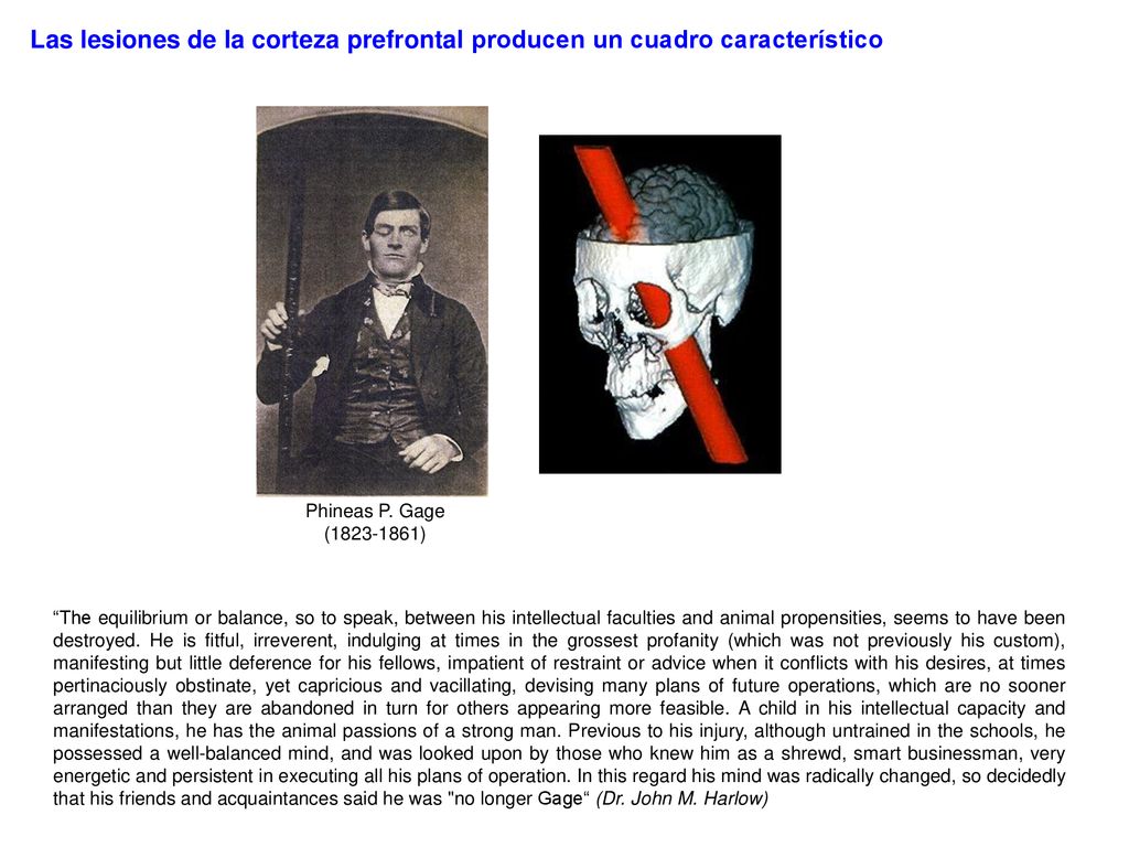 Las lesiones de la corteza prefrontal producen un cuadro característico