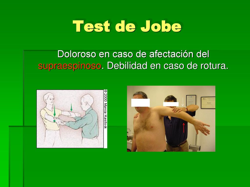 Test de Jobe Doloroso en caso de afectación del supraespinoso. Debilidad en caso de rotura.