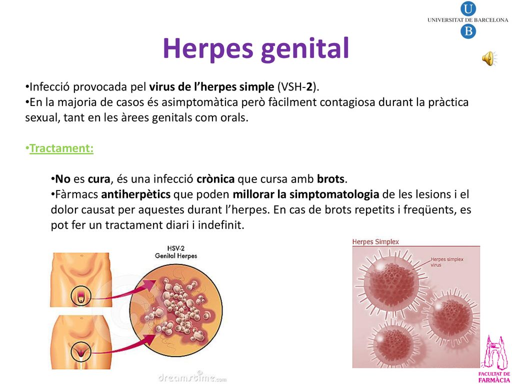 Herpes genital Infecció provocada pel virus de l’herpes simple (VSH-2).