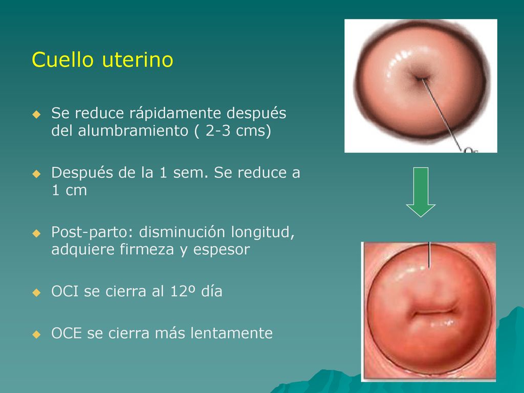 Cuello uterino Se reduce rápidamente después del alumbramiento ( 2-3 cms) Después de la 1 sem. Se reduce a 1 cm.