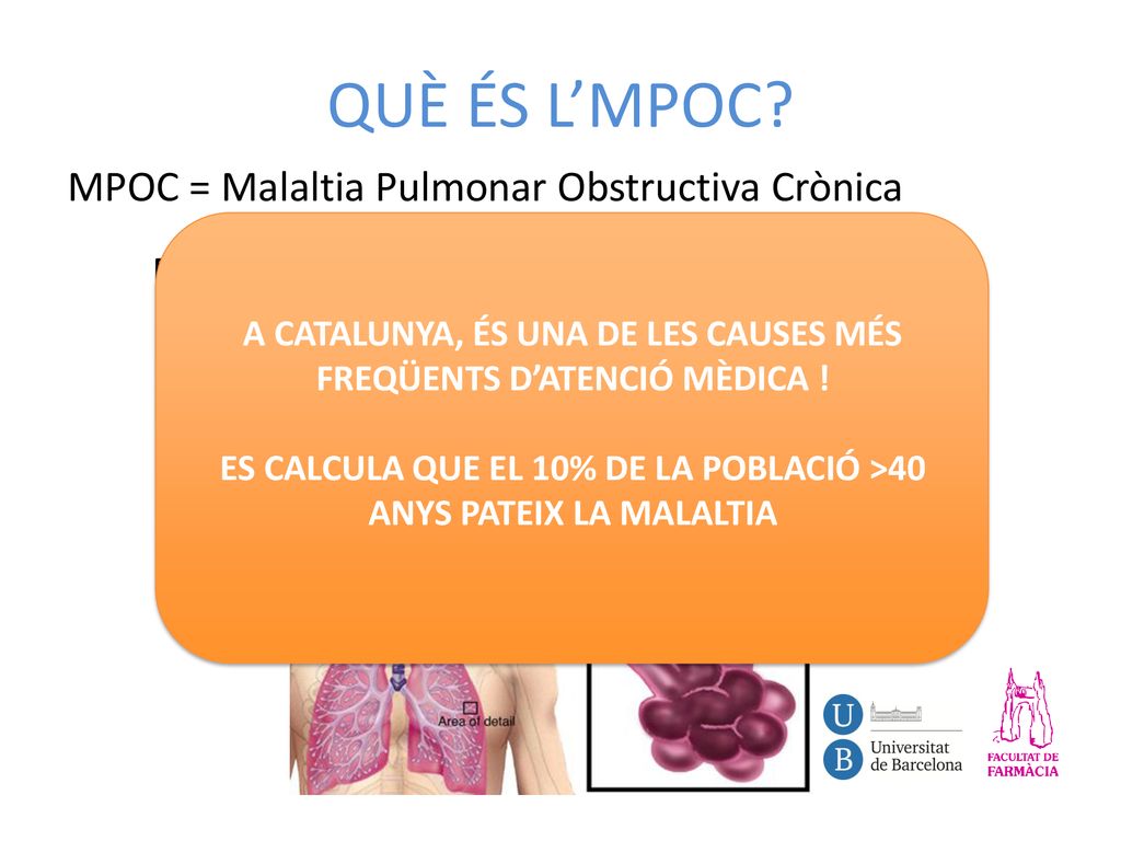 QUÈ ÉS L’MPOC MPOC = Malaltia Pulmonar Obstructiva Crònica Es produeix per la inflamació dels bronquis i la destrucció de les parets dels alvèols