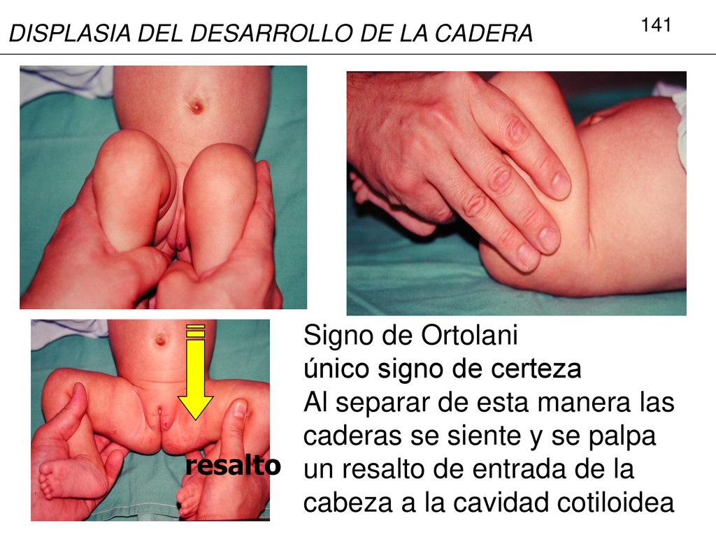 Al separar de esta manera las caderas se siente y se palpa