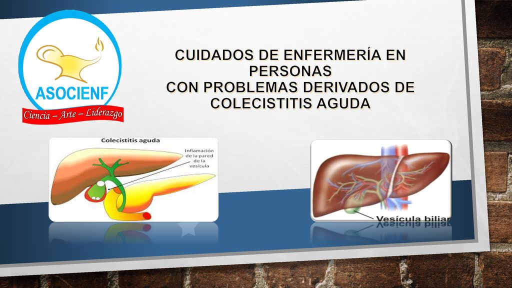 CUIDADOS DE ENFERMERÍA EN PERSONAS CON PROBLEMAS DERIVADOS DE COLECISTITIS AGUDA