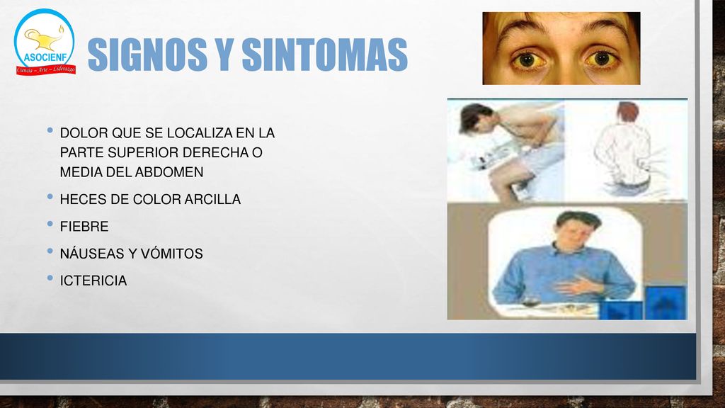 SIGNOS Y SINTOMAS dolor que se localiza en la parte superior derecha o media del abdomen. Heces de color arcilla.