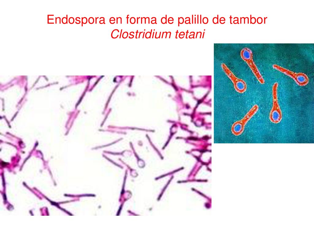 Endospora en forma de palillo de tambor Clostridium tetani