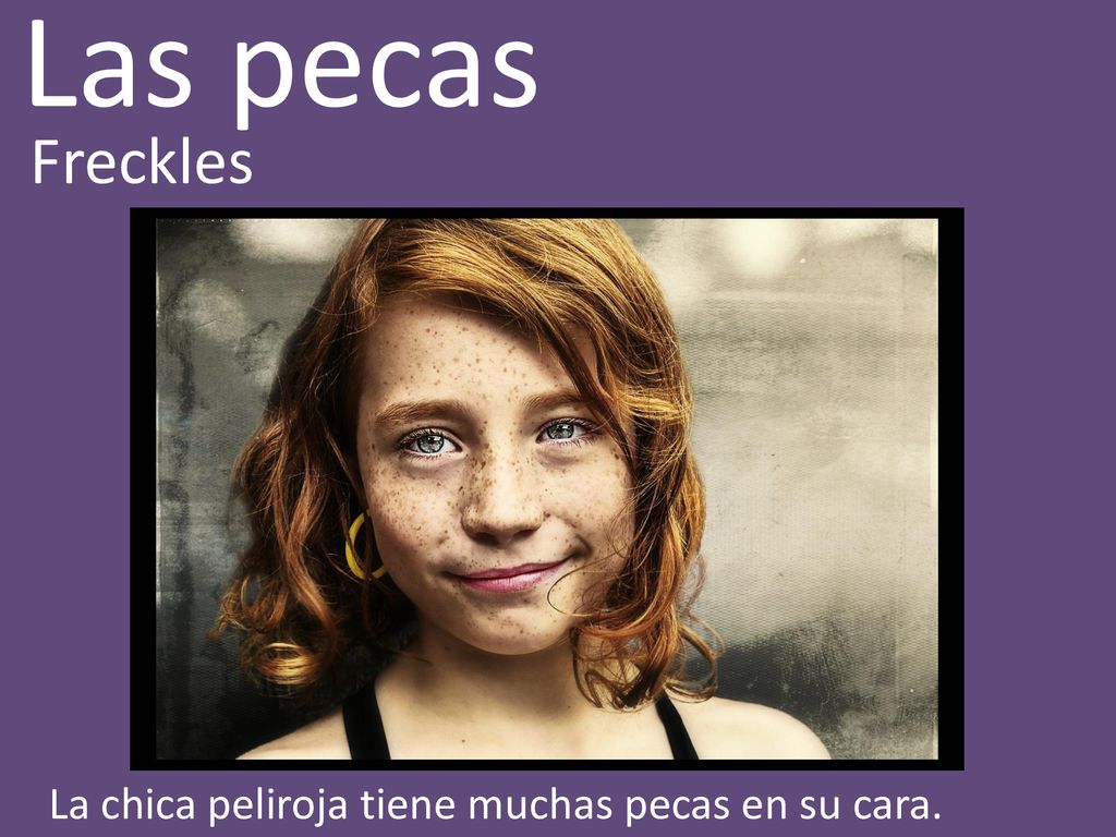 Las pecas Freckles La chica peliroja tiene muchas pecas en su cara.