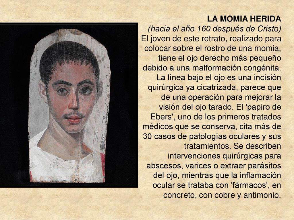 LA MOMIA HERIDA (hacia el año 160 después de Cristo)