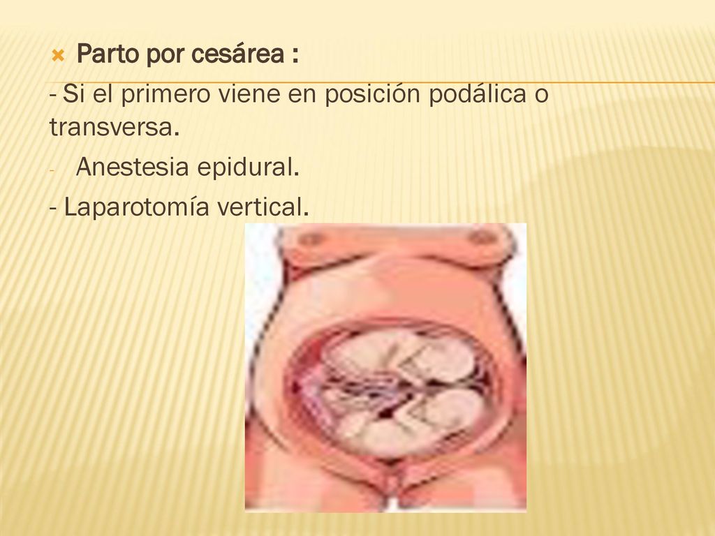 Parto por cesárea : - Si el primero viene en posición podálica o transversa.