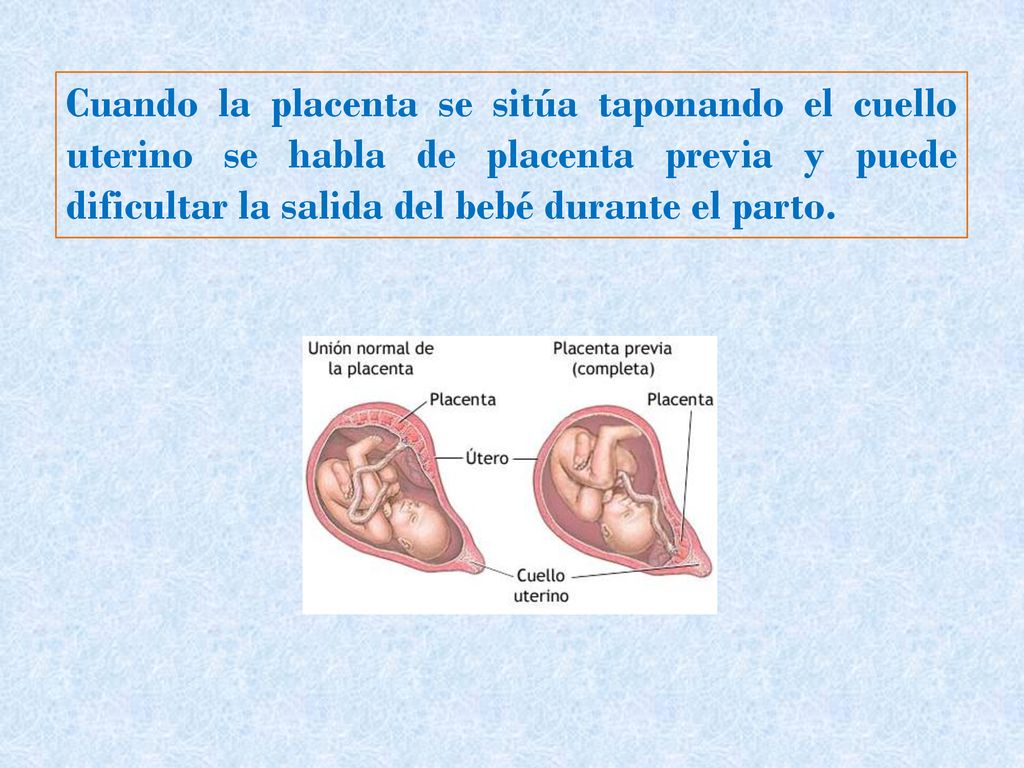 Cuando la placenta se sitúa taponando el cuello uterino se habla de placenta previa y puede dificultar la salida del bebé durante el parto.