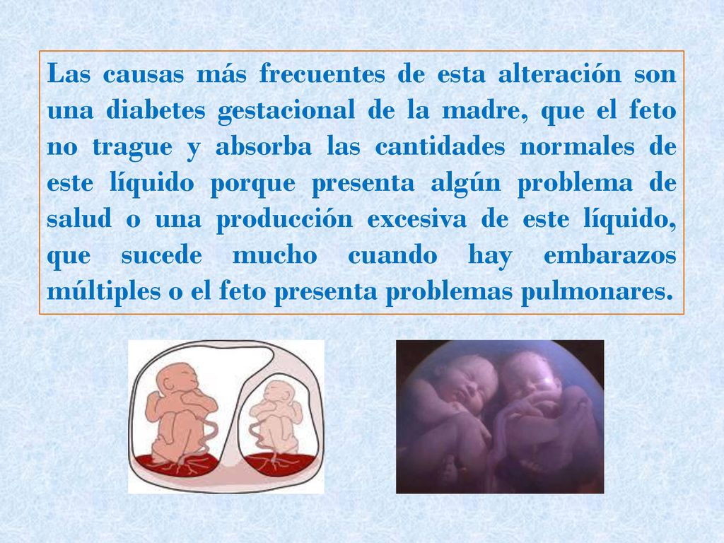 Las causas más frecuentes de esta alteración son una diabetes gestacional de la madre, que el feto no trague y absorba las cantidades normales de este líquido porque presenta algún problema de salud o una producción excesiva de este líquido, que sucede mucho cuando hay embarazos múltiples o el feto presenta problemas pulmonares.