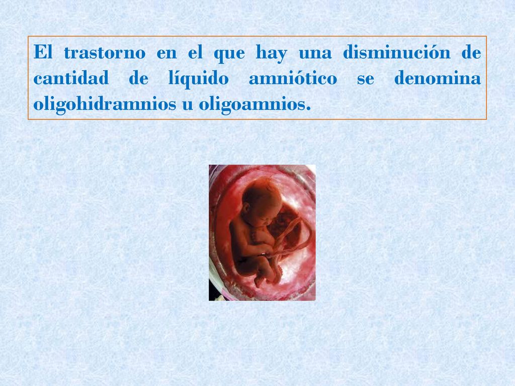 El trastorno en el que hay una disminución de cantidad de líquido amniótico se denomina oligohidramnios u oligoamnios.
