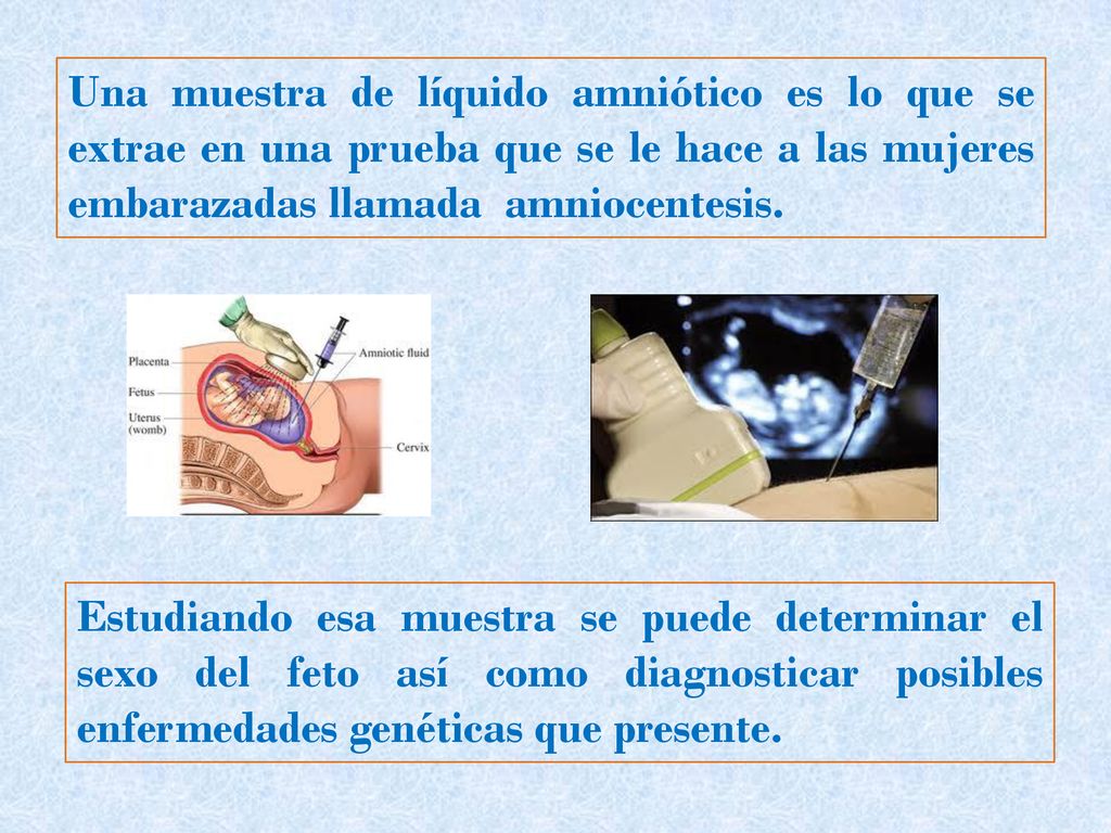 Una muestra de líquido amniótico es lo que se extrae en una prueba que se le hace a las mujeres embarazadas llamada amniocentesis.