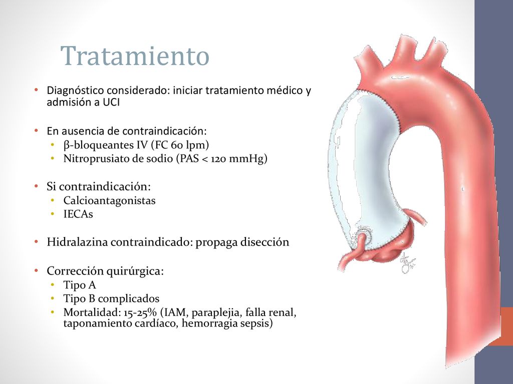 Tratamiento Diagnóstico considerado: iniciar tratamiento médico y admisión a UCI. En ausencia de contraindicación: