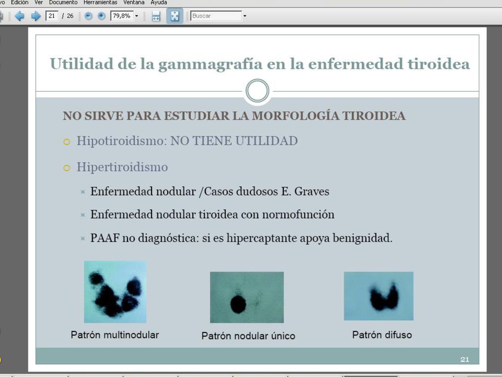 SI NODUL I TSH BAIXA: DERIVAR DIRECTAMENT A ENDOCRI, no cal demanar la gamma si no volem