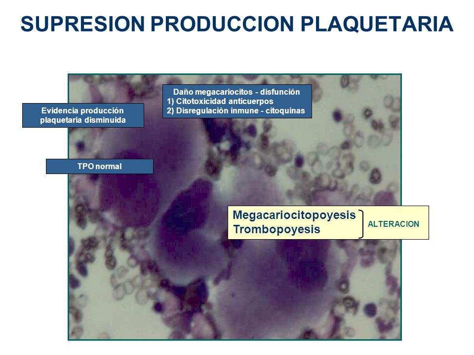 SUPRESION PRODUCCION PLAQUETARIA