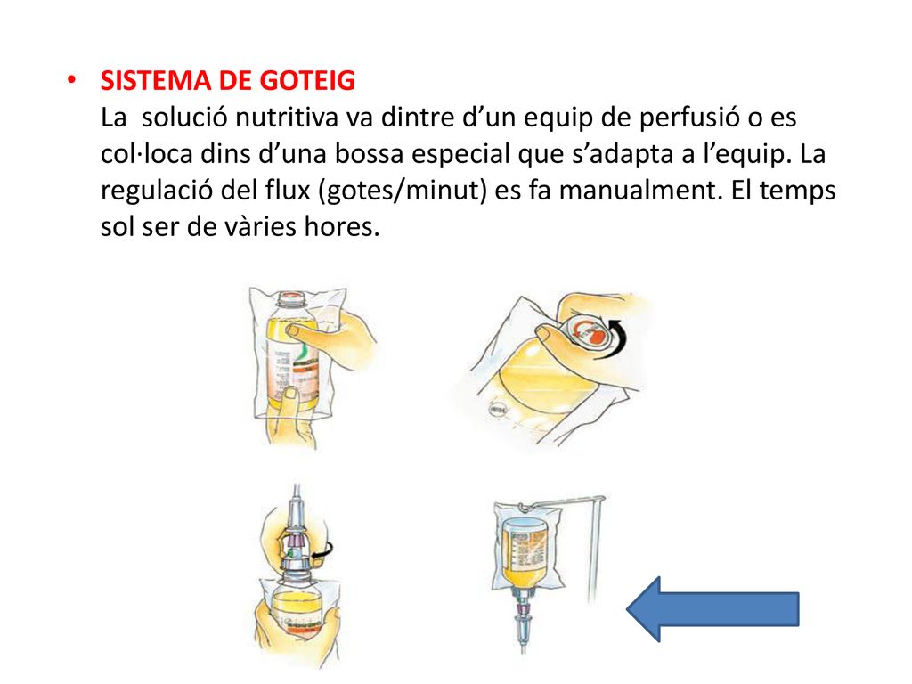 SISTEMA DE GOTEIG La solució nutritiva va dintre d’un equip de perfusió o es col·loca dins d’una bossa especial que s’adapta a l’equip.