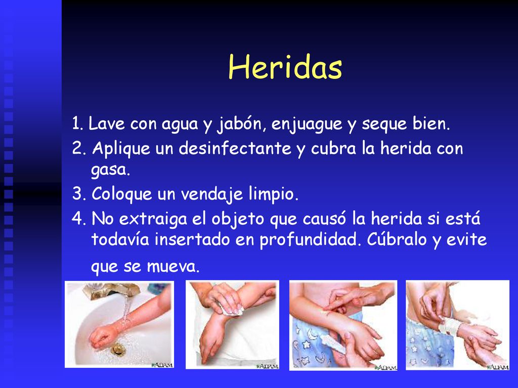 Heridas 1. Lave con agua y jabón, enjuague y seque bien.