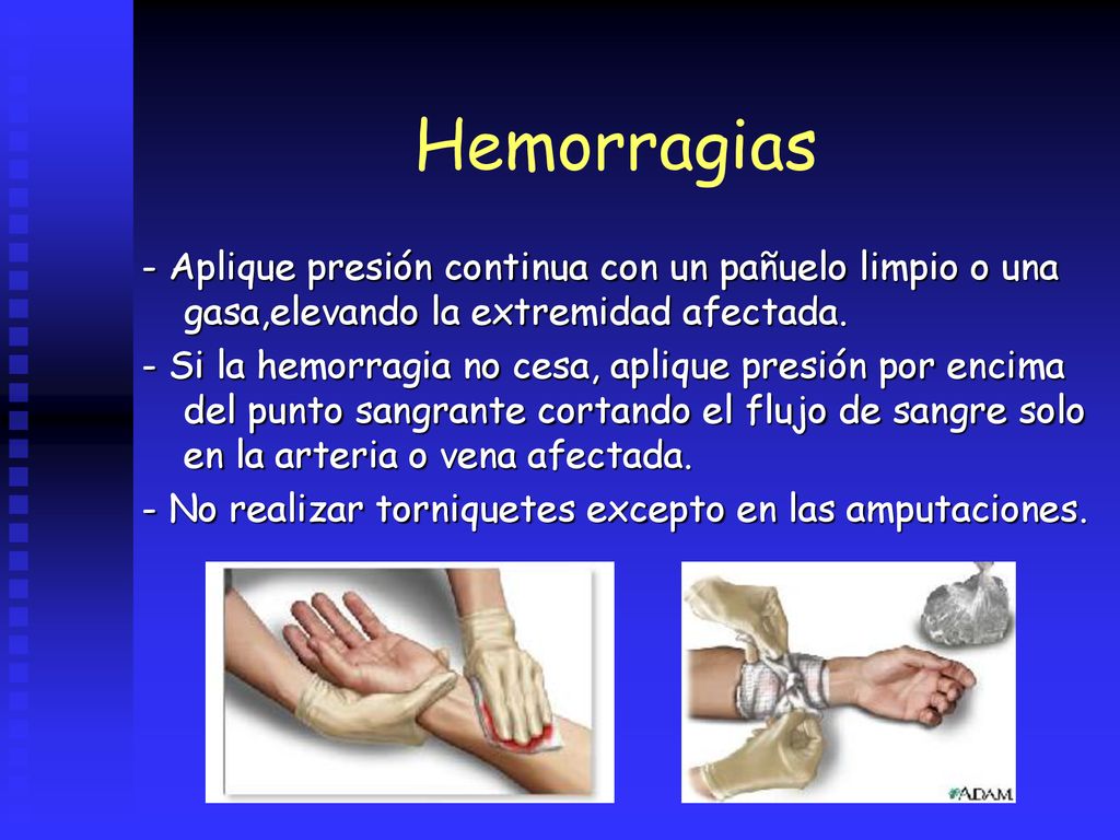 Hemorragias - Aplique presión continua con un pañuelo limpio o una gasa,elevando la extremidad afectada.