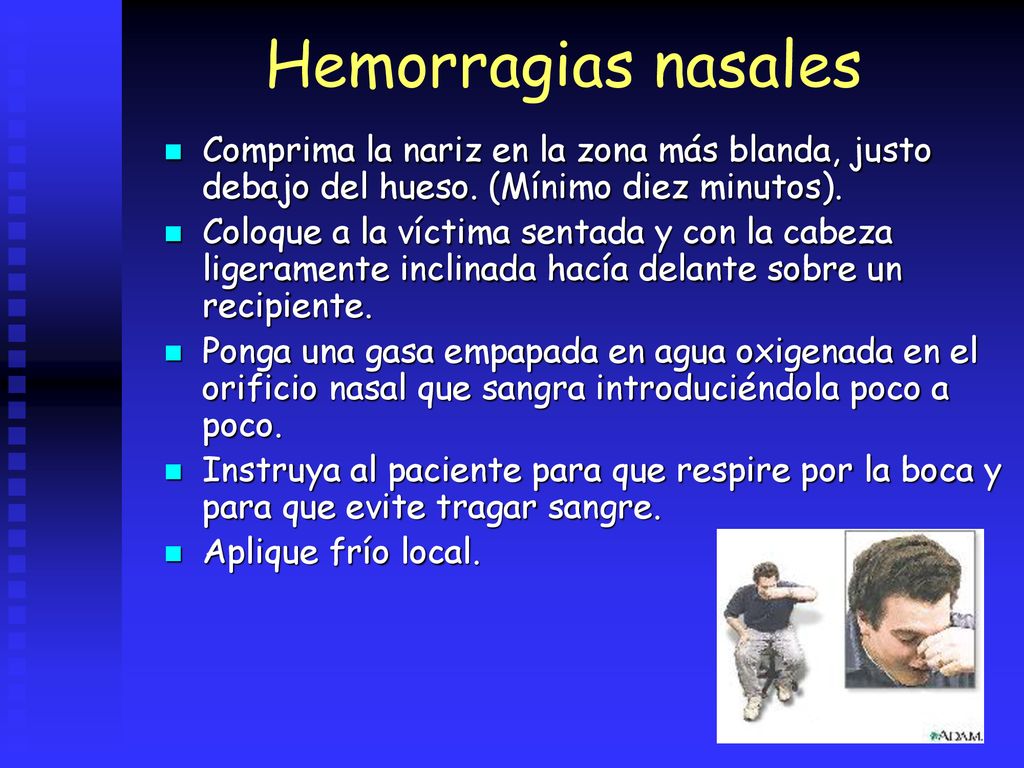 Hemorragias nasales Comprima la nariz en la zona más blanda, justo debajo del hueso. (Mínimo diez minutos).