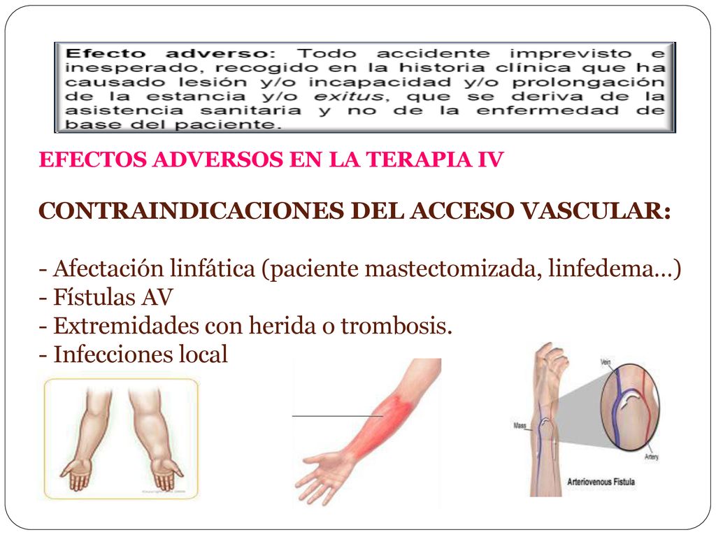 EFECTOS ADVERSOS EN LA TERAPIA IV Contraindicaciones del acceso vascular: - Afectación linfática (paciente mastectomizada, linfedema…) - Fístulas AV - Extremidades con herida o trombosis.