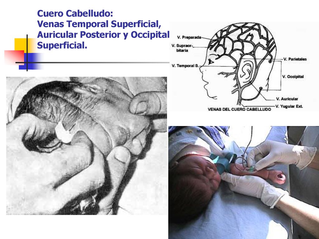 Cuero Cabelludo: Venas Temporal Superficial, Auricular Posterior y Occipital Superficial.