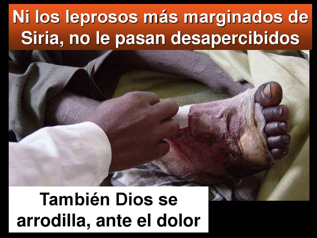 Ni los leprosos más marginados de Siria, no le pasan desapercibidos