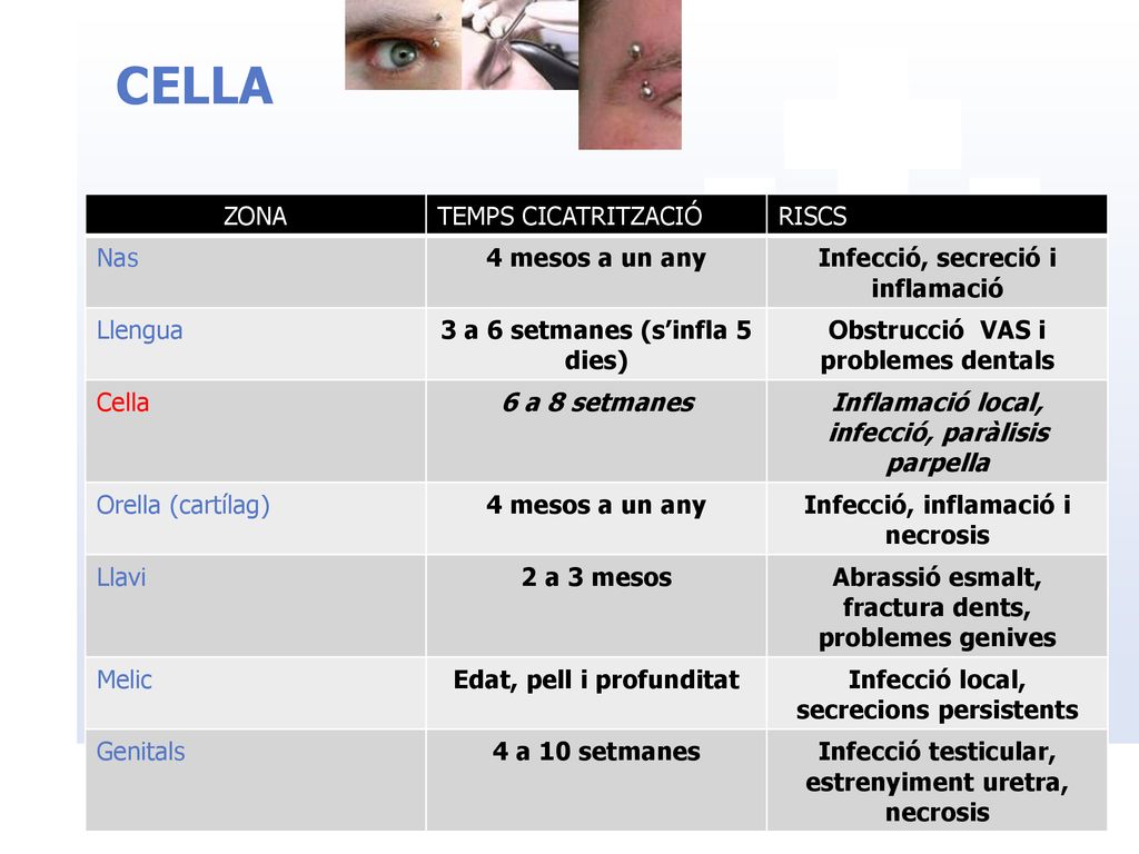 CELLA ZONA TEMPS CICATRITZACIÓ RISCS Nas 4 mesos a un any