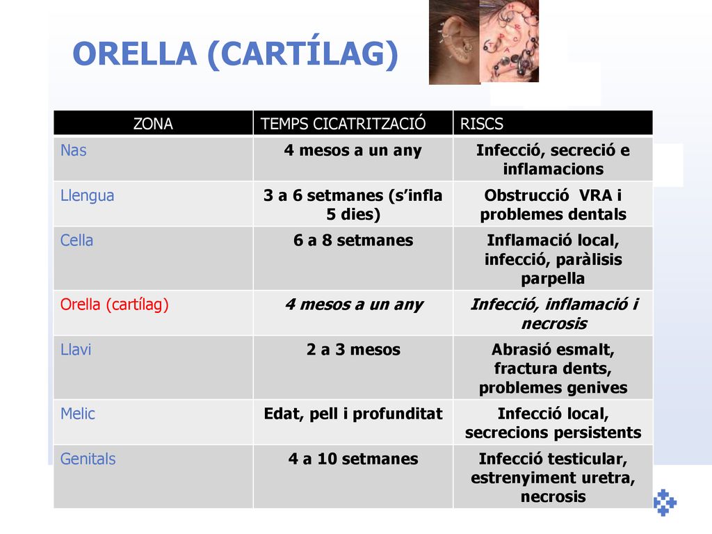 ORELLA (CARTÍLAG) ZONA TEMPS CICATRITZACIÓ RISCS Nas 4 mesos a un any