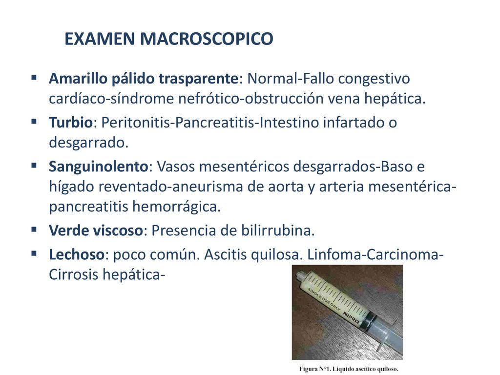 EXAMEN MACROSCOPICO Amarillo pálido trasparente: Normal-Fallo congestivo cardíaco-síndrome nefrótico-obstrucción vena hepática.