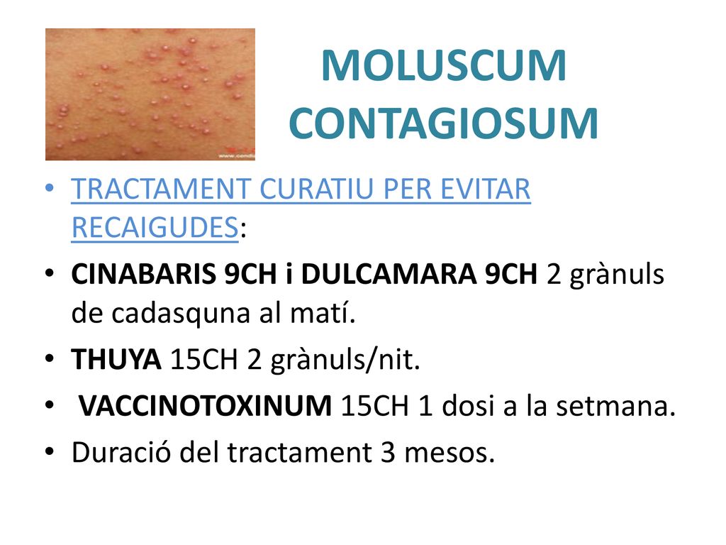 MOLUSCUM CONTAGIOSUM TRACTAMENT CURATIU PER EVITAR RECAIGUDES: