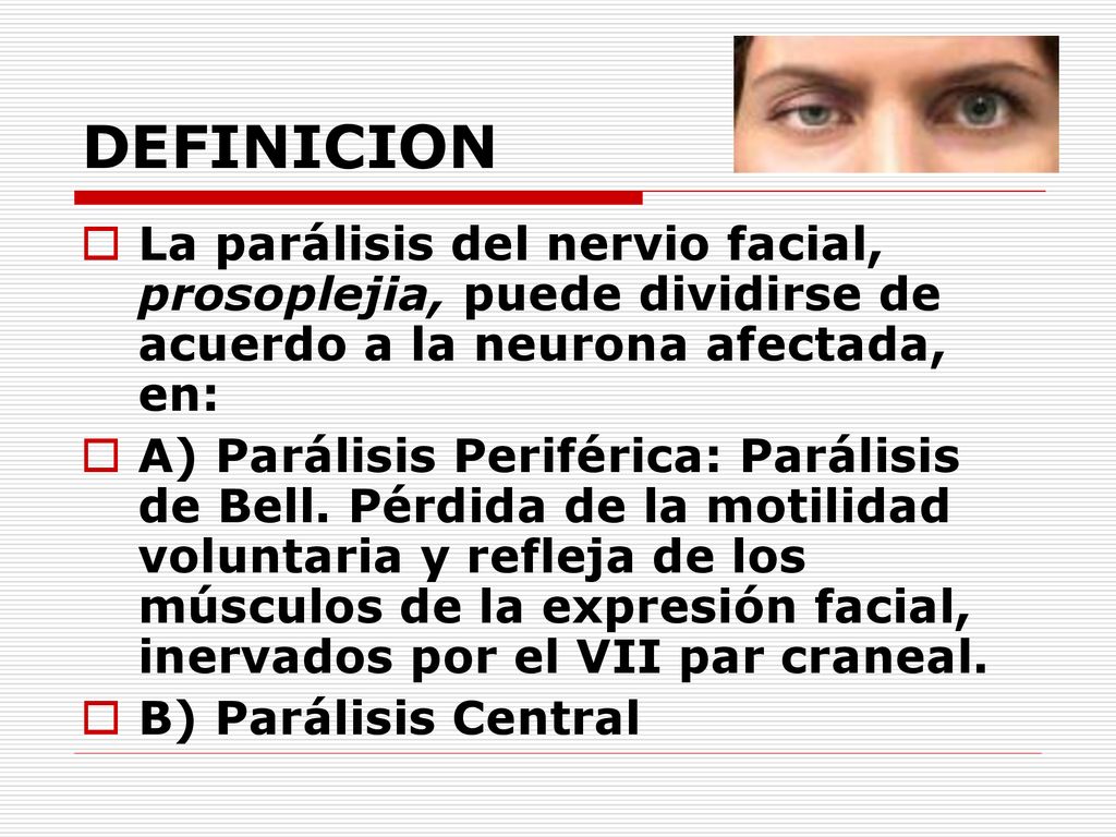 DEFINICION La parálisis del nervio facial, prosoplejia, puede dividirse de acuerdo a la neurona afectada, en: