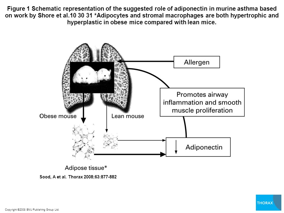 Figure 1 Schematic representation of the suggested role of adiponectin in murine asthma based on work by Shore et al *Adipocytes and stromal macrophages are both hypertrophic and hyperplastic in obese mice compared with lean mice.