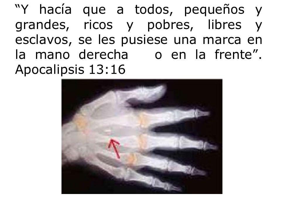 Y hacía que a todos, pequeños y grandes, ricos y pobres, libres y esclavos, se les pusiese una marca en la mano derecha o en la frente .