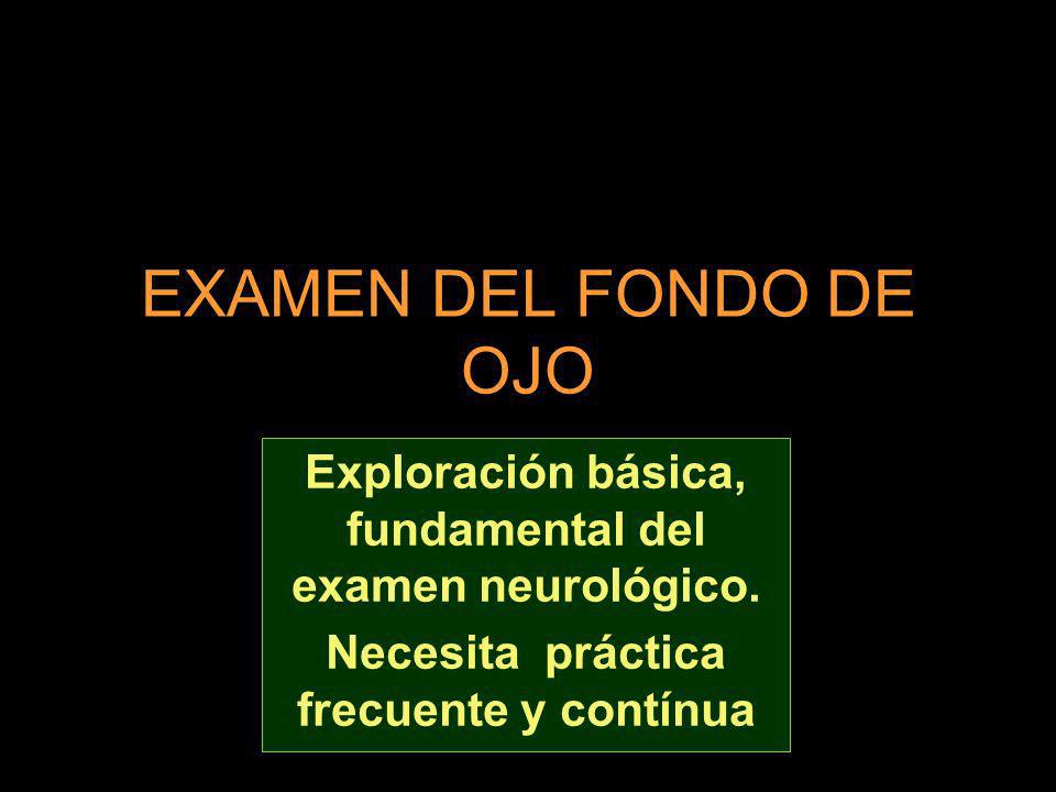EXAMEN DEL FONDO DE OJO Exploración básica, fundamental del examen neurológico.