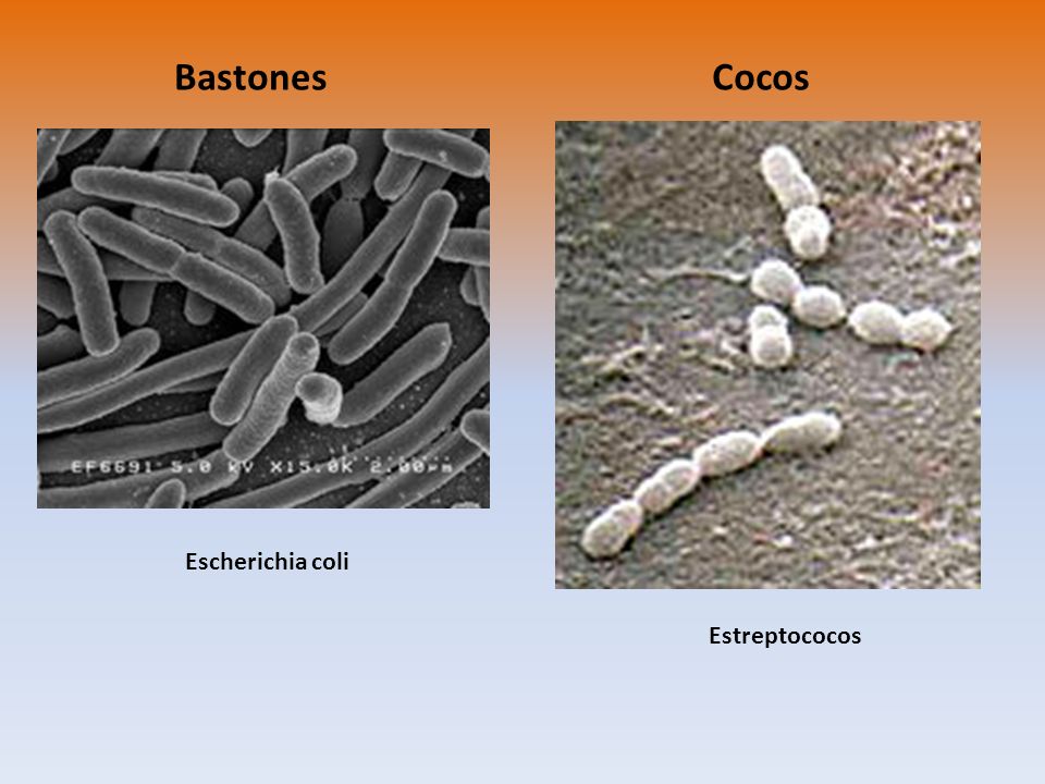 Bastones Cocos Escherichia coli Estreptococos