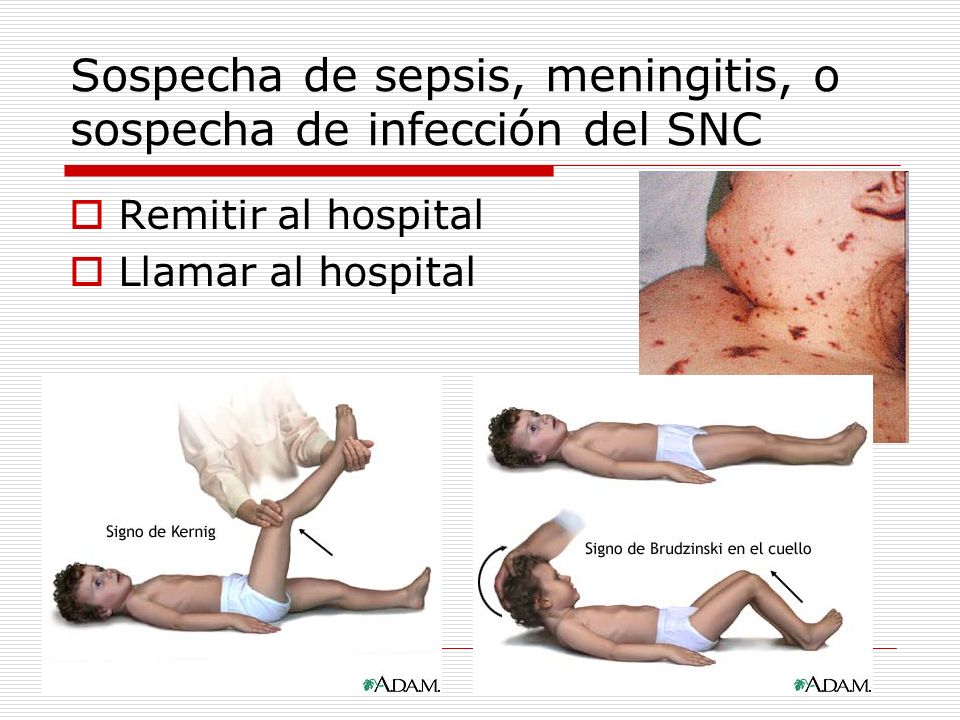 Sospecha de sepsis, meningitis, o sospecha de infección del SNC