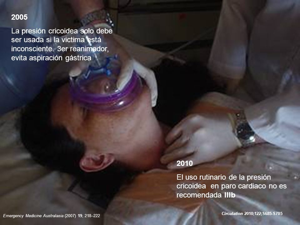 2005 La presión cricoidea solo debe ser usada si la victima está inconsciente. 3er reanimador, evita aspiración gástrica.