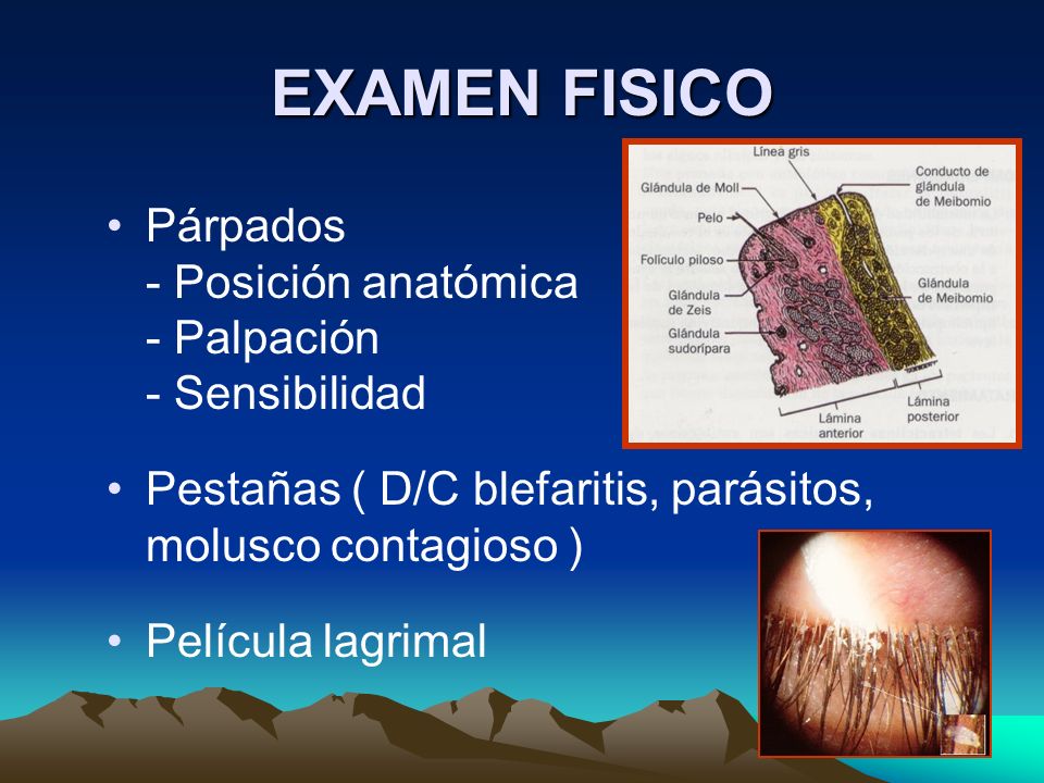 EXAMEN FISICO Párpados - Posición anatómica - Palpación - Sensibilidad