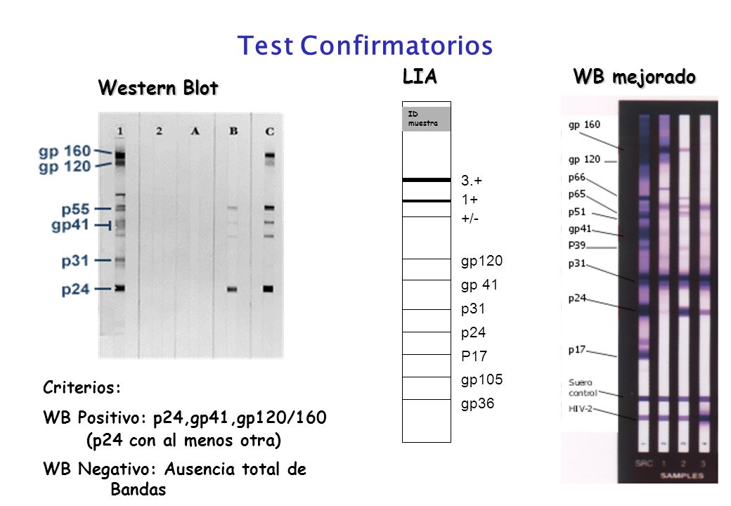 Test Confirmatorios LIA WB mejorado Western Blot Criterios: