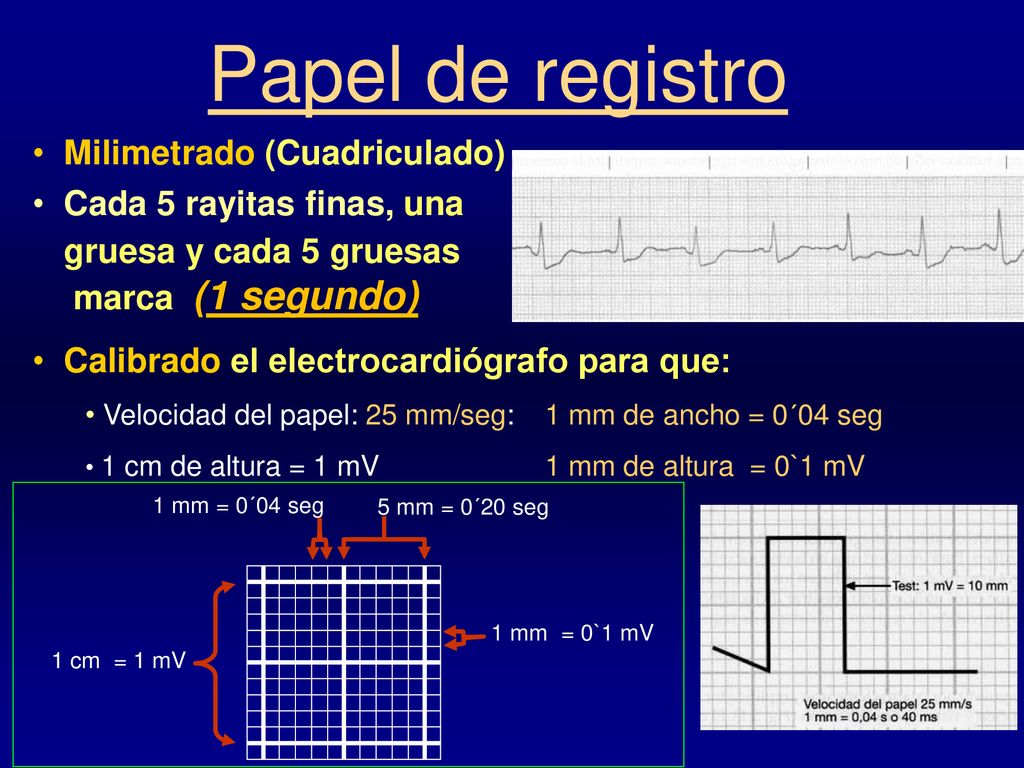 Papel de registro Milimetrado (Cuadriculado) Cada 5 rayitas finas, una