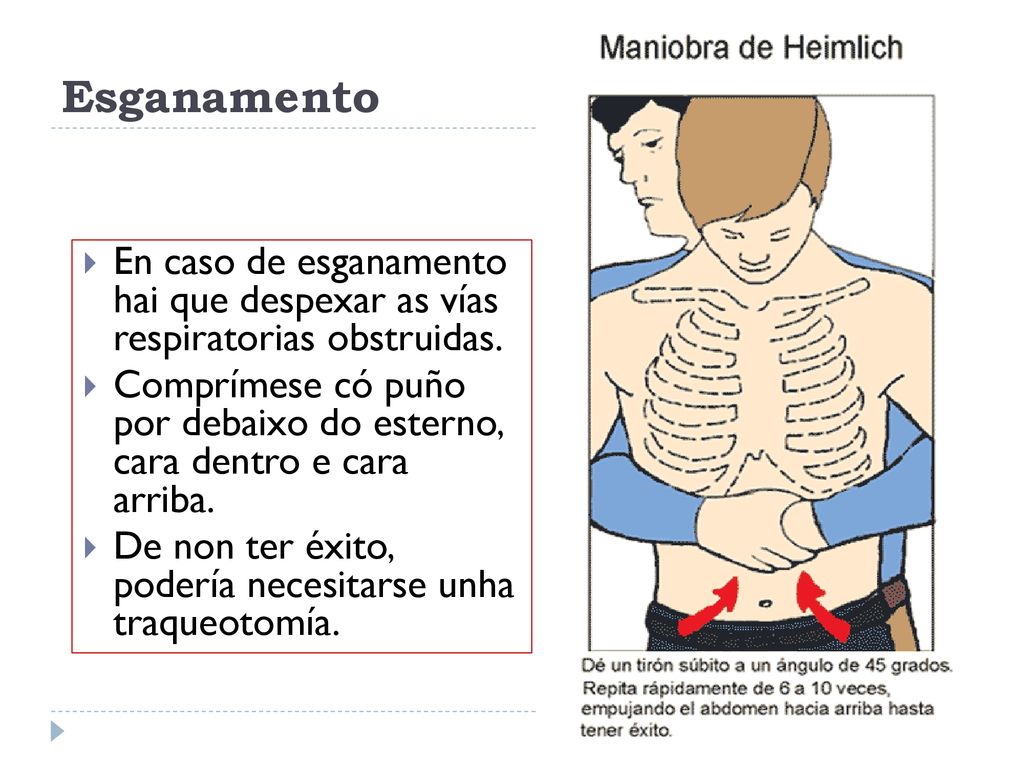 Esganamento En caso de esganamento hai que despexar as vías respiratorias obstruidas.