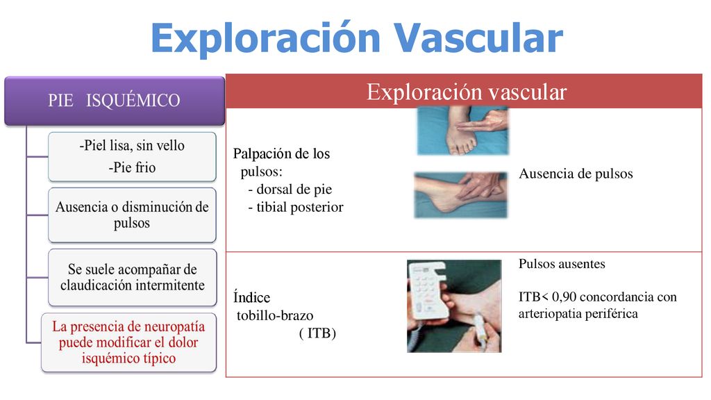 Exploración Vascular Exploración vascular Palpación de los pulsos:
