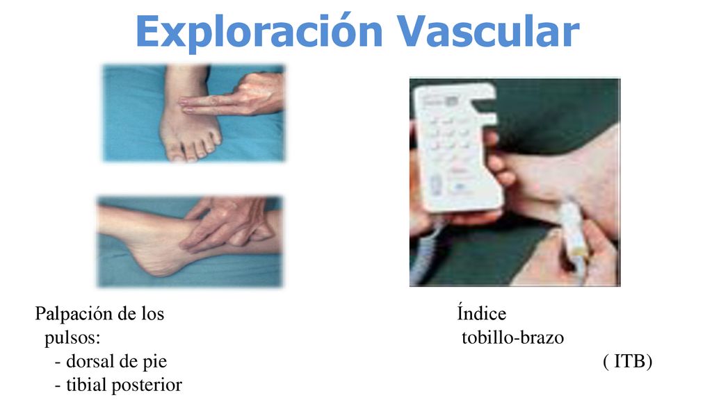 Exploración Vascular Palpación de los pulsos: - dorsal de pie